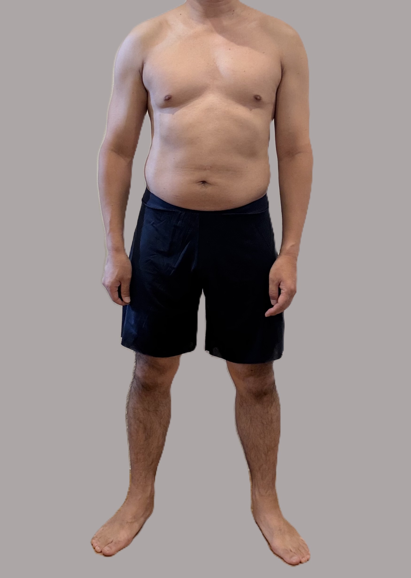 49歳さこ氏のBefore体型